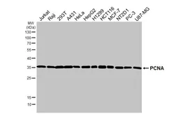 Anti-PCNA antibody [HL1966] used in Western Blot (WB). GTX637859