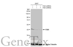 Anti-FAH antibody [HL1970] used in Western Blot (WB). GTX637863