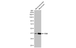 Anti-FAH antibody [HL1970] used in Western Blot (WB). GTX637863