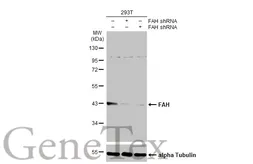 Anti-FAH antibody [HL1972] used in Western Blot (WB). GTX637865