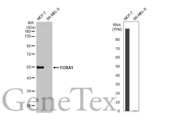 Anti-FOXA1 antibody [HL1974] used in Western Blot (WB). GTX637867