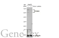 Anti-FOXA1 antibody [HL1974] used in Western Blot (WB). GTX637867