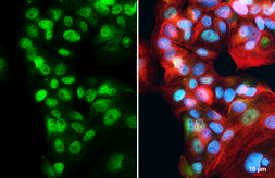Anti-FOXA1 antibody [HL1974] used in Immunocytochemistry/ Immunofluorescence (ICC/IF). GTX637867