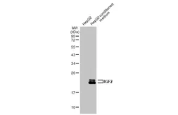 Anti-IGF2 antibody [HL1979] used in Western Blot (WB). GTX637872