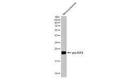 Anti-IGF2 antibody [HL1979] used in Western Blot (WB). GTX637872