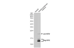 Anti-IGF2 antibody [HL1982] used in Western Blot (WB). GTX637875