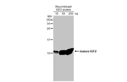 Anti-IGF2 antibody [HL1982] used in Western Blot (WB). GTX637875