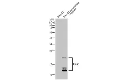 Anti-IGF2 antibody [HL1982] used in Western Blot (WB). GTX637875