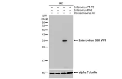 Anti-Enterovirus D68 VP1 antibody [HL1997] used in Western Blot (WB). GTX637898