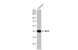 Anti-Wnt2 antibody [HL1999] used in Western Blot (WB). GTX637900