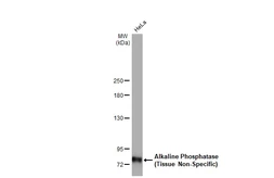 Anti-Alkaline Phosphatase (Tissue Non-Specific) antibody [HL2003] used in Western Blot (WB). GTX637904