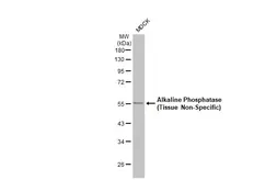 Anti-Alkaline Phosphatase (Tissue Non-Specific) antibody [HL2003] used in Western Blot (WB). GTX637904