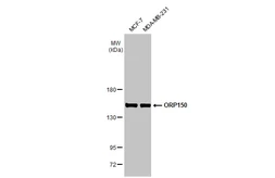 Anti-ORP150 antibody [HL2006] used in Western Blot (WB). GTX637907