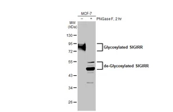 Anti-SIGIRR antibody [HL2007] used in Western Blot (WB). GTX637908