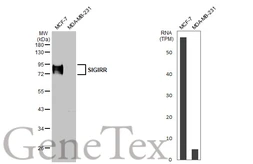 Anti-SIGIRR antibody [HL2008] used in Western Blot (WB). GTX637909