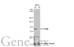 Anti-PFKM antibody [HL2010] used in Western Blot (WB). GTX637911
