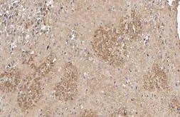 Anti-PIP5K1A antibody [HL2011] used in IHC (Paraffin sections) (IHC-P). GTX637912