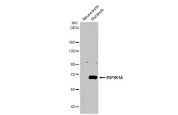 Anti-PIP5K1A antibody [HL2011] used in Western Blot (WB). GTX637912