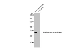 Anti-Choline Acetyltransferase antibody [HL2014] used in Western Blot (WB). GTX637915