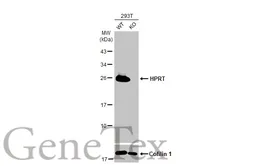 Anti-HPRT antibody [HL2015] used in Western Blot (WB). GTX637916