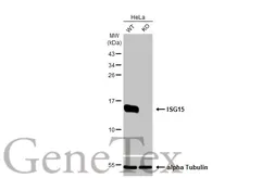 Anti-ISG15 antibody [HL2016] used in Western Blot (WB). GTX637917