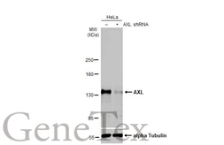 Anti-AXL antibody [HL2021] used in Western Blot (WB). GTX637922