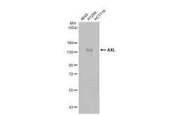 Anti-AXL antibody [HL2021] used in Western Blot (WB). GTX637922