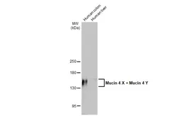 Anti-Mucin 4 X + Mucin 4 Y antibody [HL2026] used in Western Blot (WB). GTX637927