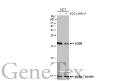 Anti-SOD1 antibody [HL2033] used in Western Blot (WB). GTX637934