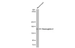 Anti-Desmoglein 2 antibody [HL2036] used in Western Blot (WB). GTX637937