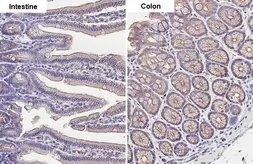 Anti-Desmoglein 2 antibody [HL2036] used in IHC (Paraffin sections) (IHC-P). GTX637937