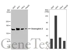 Anti-Desmoglein 2 antibody [HL2036] used in Western Blot (WB). GTX637937