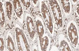 Anti-Bcl-XL antibody [HL2038] used in IHC (Paraffin sections) (IHC-P). GTX637939