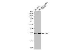 Anti-Pet1 antibody [HL2043] used in Western Blot (WB). GTX637944