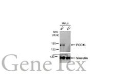 Anti-PODXL antibody [HL2047] used in Western Blot (WB). GTX637951