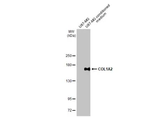 Anti-COL1A2 antibody [HL2048] used in Western Blot (WB). GTX637952