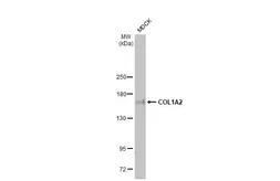 Anti-COL1A2 antibody [HL2048] used in Western Blot (WB). GTX637952