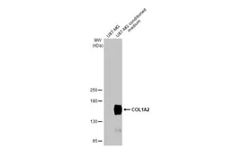 Anti-COL1A2 antibody [HL2048] used in Western Blot (WB). GTX637952