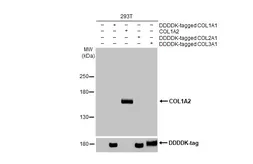 Anti-COL1A2 antibody [HL2048] used in Western Blot (WB). GTX637952