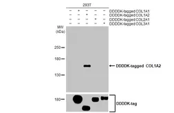 Anti-COL1A2 antibody [HL2049] used in Western Blot (WB). GTX637953