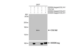 Anti-COL1A2 antibody [HL2049] used in Western Blot (WB). GTX637953