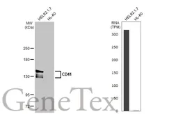 Anti-CD41 antibody [HL2052] used in Western Blot (WB). GTX637956