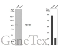 Anti-TBC1D5 antibody [HL2054] used in Western Blot (WB). GTX637958
