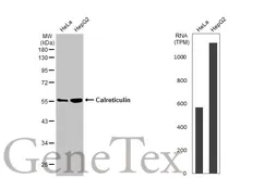 Anti-Calreticulin antibody [HL2057] used in Western Blot (WB). GTX637961