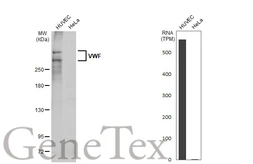 Anti-VWF antibody [HL2058] used in Western Blot (WB). GTX637962
