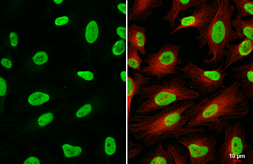 Anti-HMGB1 antibody [HL2060] used in Immunocytochemistry/ Immunofluorescence (ICC/IF). GTX637964