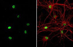 Anti-HMGB1 antibody [HL2060] used in Immunocytochemistry/ Immunofluorescence (ICC/IF). GTX637964