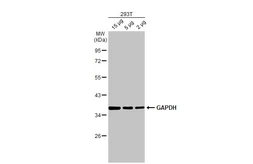 Anti-GAPDH antibody [HL2062] used in Western Blot (WB). GTX637966
