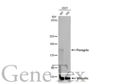 Anti-Peregrin antibody [HL2064] used in Western Blot (WB). GTX637968