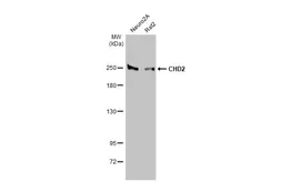 Anti-CHD2 antibody [HL2066] used in Western Blot (WB). GTX637970